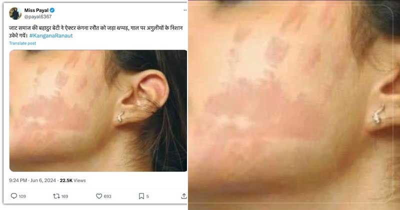 Fact Check : મહિલા કર્મચારીએ કંગના રનૌતને માર્યો ગાલ પર એટલો જોરથી થપ્પડ કે સૂજી ગયો ગાલ…તસવીર થઇ વાયરલ