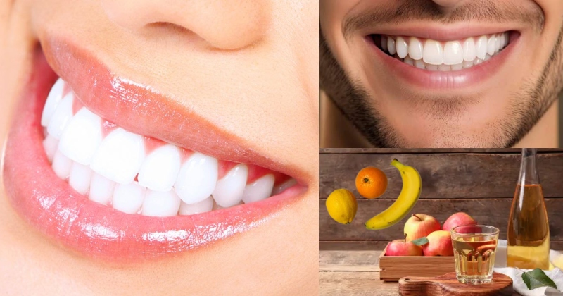 મોતીની જેમ સફેદ થઇ જશે પીળા દાંત, અજમાવી જુઓ આ ઘરેલુ ઉપાય