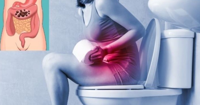 સાવધાન! સવારે બાથરુમમાં જતાં જ મળતો આ સંકેત હોય શકે છે આંતરડાના કેન્સરની શરુઆતનું પહેલું લક્ષણ, અવગણશો નહીં, નહીં તો..!