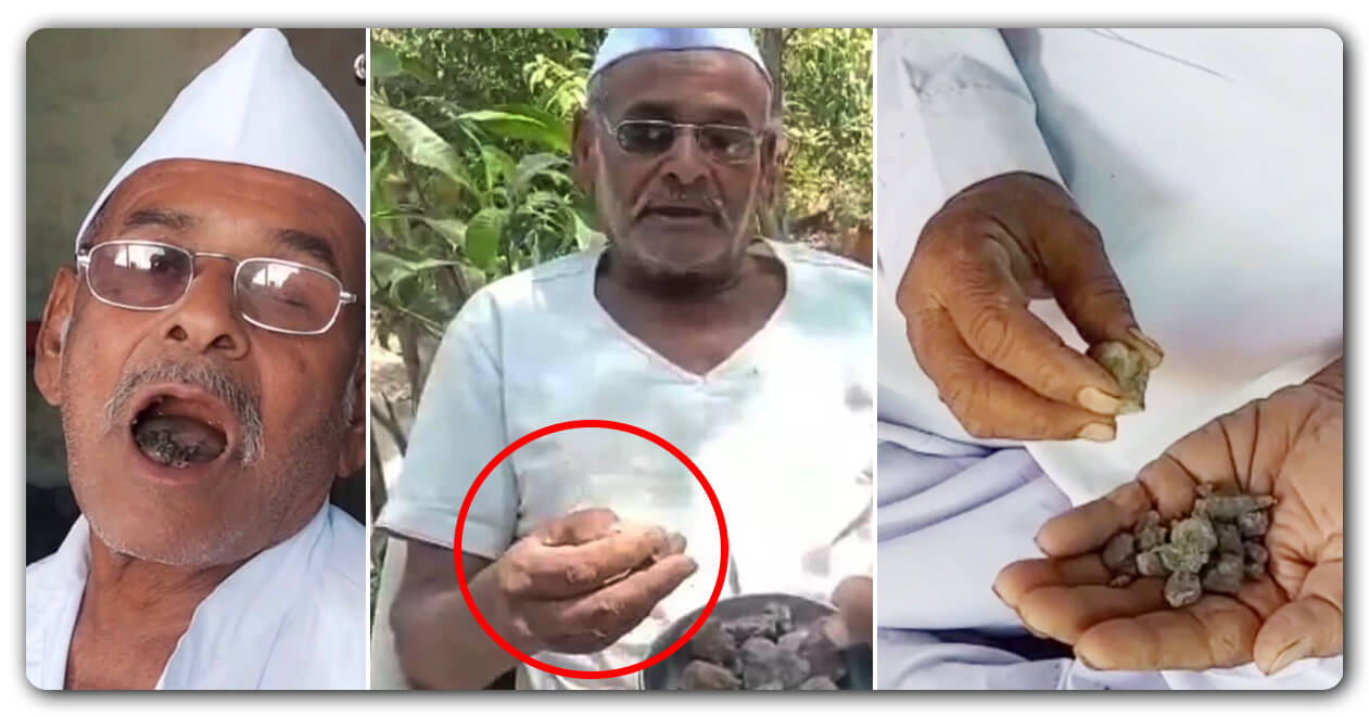 80 વર્ષના આ દાદા 30 વર્ષથી ખાય છે રોજના 250 ગ્રામ પથ્થર, ડોક્ટર પણ તેને જોઈને રહી ગયા હેરાન, જાણો કેવી રીતે થઇ હતી શરૂઆત